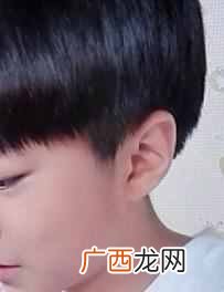 “反骨耳”是什么样子 什么是反骨