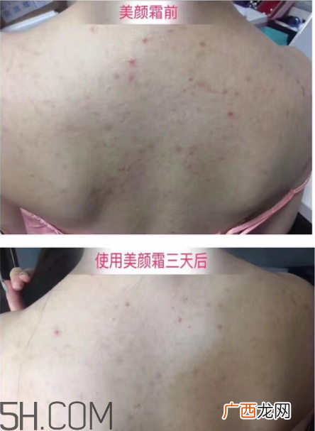 伊妮娜美颜霜有激素吗 伊妮娜美颜霜有依赖吗