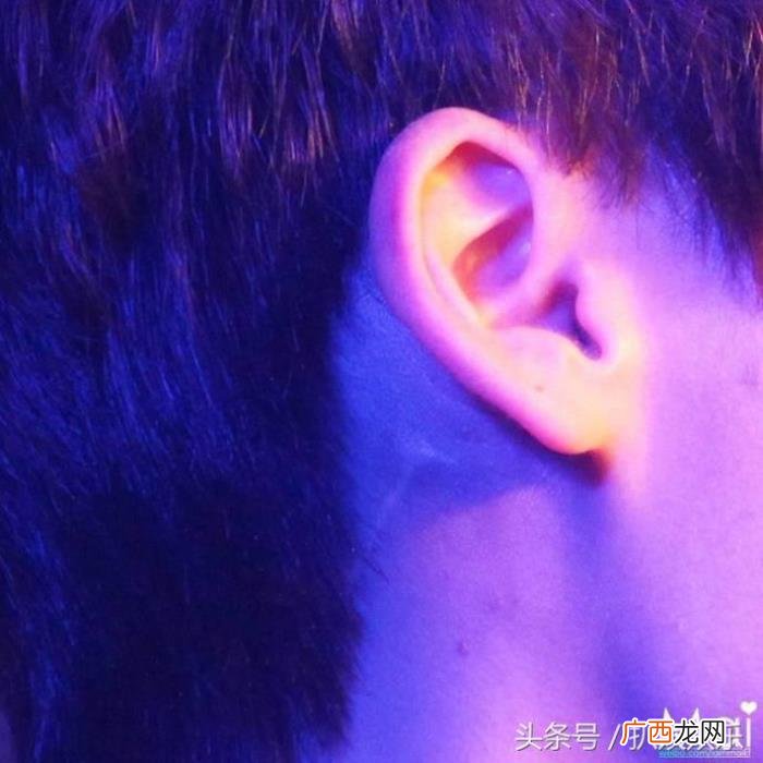 李易峰疤痕，李易峰古剑受的伤这疤痕可能一辈子为苏苏留下的印记