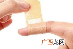 创可贴可以贴一晚上吗？睡觉贴创可贴好吗？