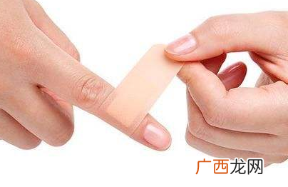 创可贴会留疤吗？创口贴贴了能不留疤吗？