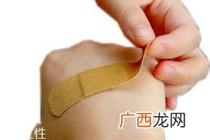 创可贴会留疤吗？创口贴贴了能不留疤吗？