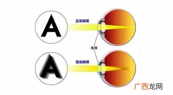 教你怎么缓解散光症状 什么是散光眼