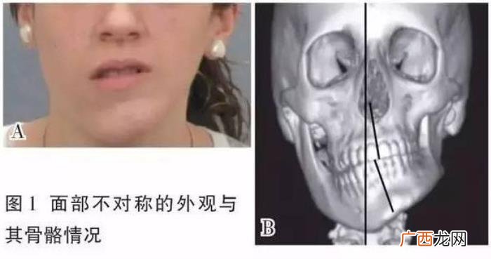 范冰冰脸歪，造成范冰冰不对称脸的这些不良习惯你还不改