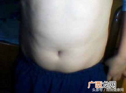 用什么方法减肥最快最有效（每天坚持这几个动