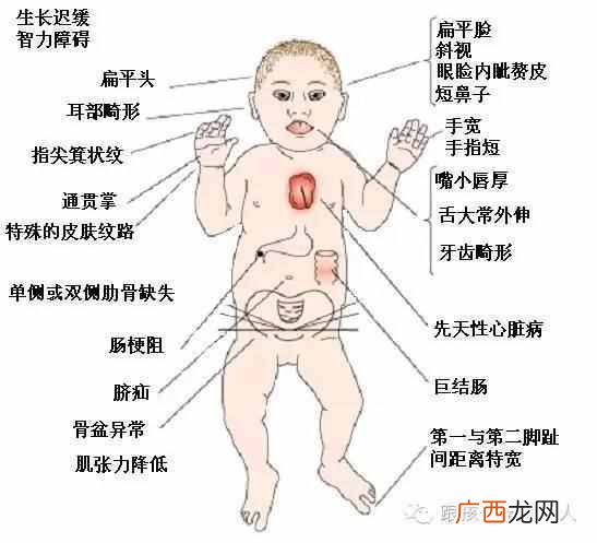 唐氏筛查是什么时候检查（唐氏筛查主要是做什