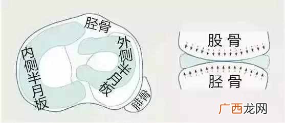 半月板是什么位置 半月板是什么原因引起的