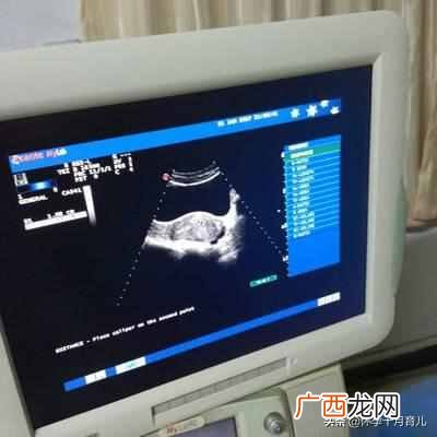 怀孕一个月有什么症状(孕妈需要注意的这些问