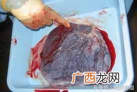 紫河车有什么作用 紫河车是什么的胎盘