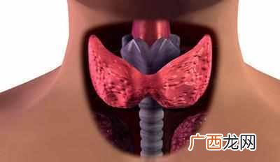 甲亢有哪些症状 什么是甲亢病