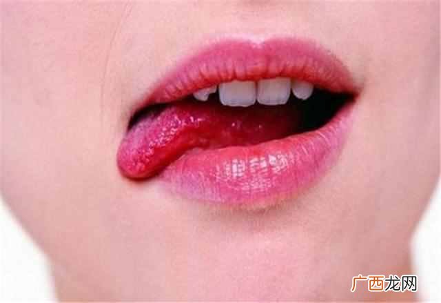 帮你从根本上解决问题 嘴角烂是什么原因