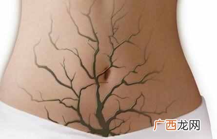 经期饮食注意事项 月经来了吃什么好排毒