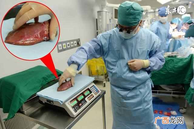 食疗方案教你养肝 肝病吃什么好