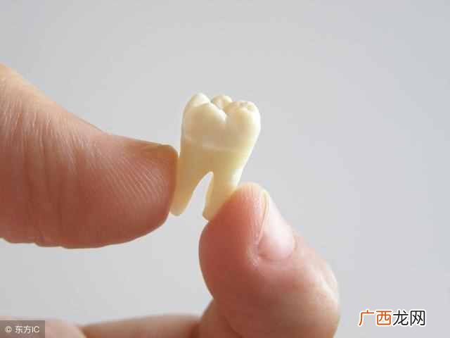 镶牙用什么材料好（教你一招怎么选购适合自己