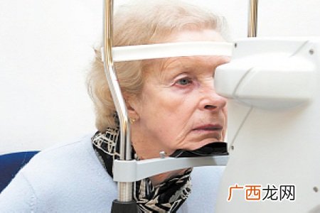 白内障的早期症状年纪大近视也会加深