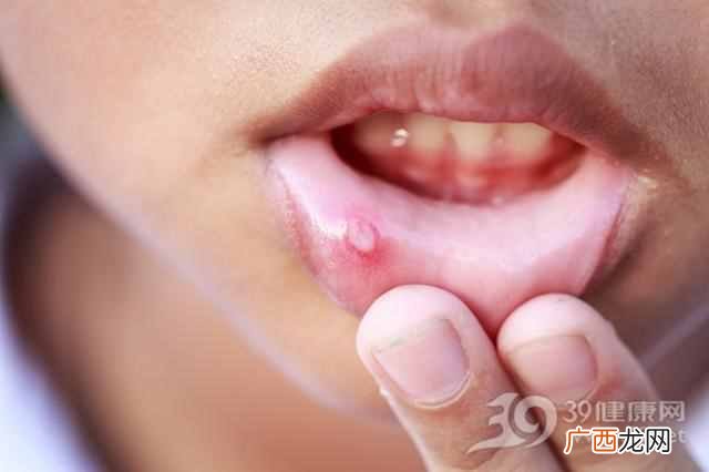 肝病有什么症状（肝病最常见的症状有哪些，怎