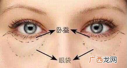 卧蚕和眼袋的区别 卧蚕是什么样子