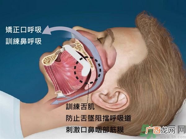 干燥症是怎么得的?不能离开水?