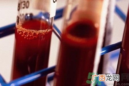 贫血的症状贫血的人吃什么补血最快?
