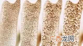 睾酮是什么原因造成 睾酮是什么意思