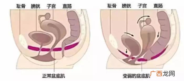 产后夫妻生活没感觉 生完孩子再做还有感觉吗