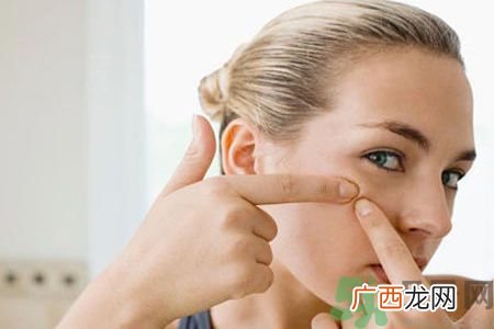 牙膏可以祛痘吗？牙膏可以祛黑头吗？