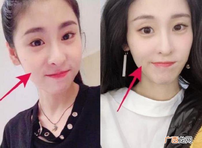 张碧晨化妆，张碧晨不用化妆品只用美容仪护肤方式火了