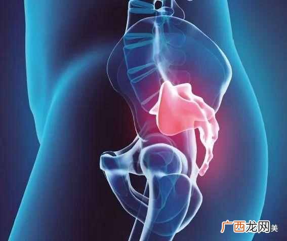 坐骨神经痛吃什么药好得快（坐骨神经痛知识大