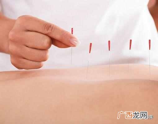 坐骨神经痛吃什么药好得快（坐骨神经痛知识大