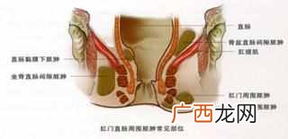 肛瘘最全的治疗方案 什么是肛瘘有哪些症状