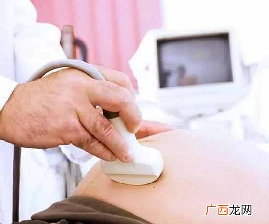 唐氏综合症是什么（什么原因会造成唐氏综合症