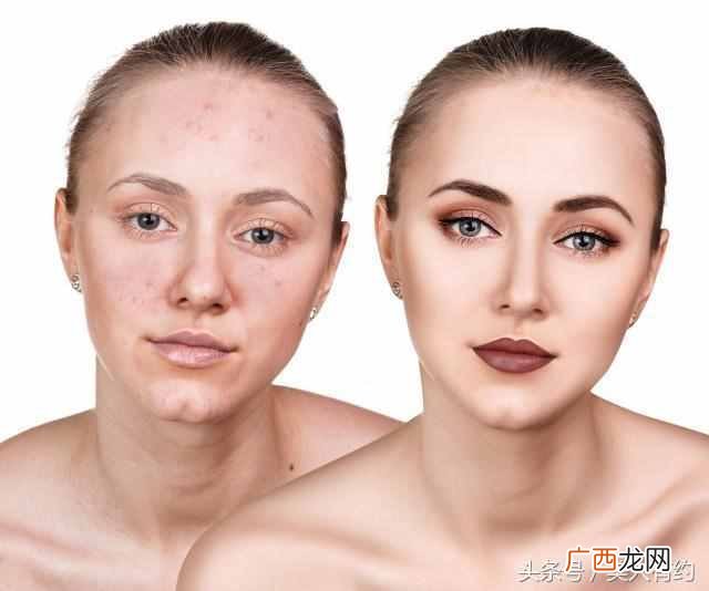 眉毛上长痘痘是什么原因（常见原因分析，快速