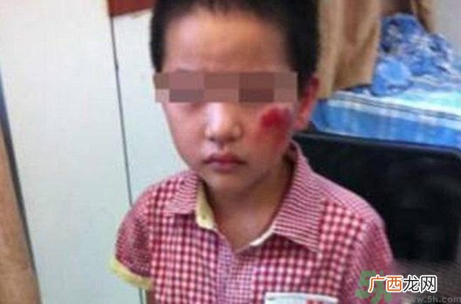 男孩遭校长暴打的结果是什么?男孩遭校长暴打的真相是什么?
