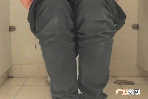 肛裂治疗方法 肛裂用什么药