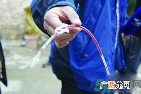 医疗垃圾做成一次性餐具是怎么回事？医疗垃圾的危害有哪些？
