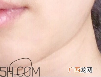 伊诗兰顿眼膜好用吗？伊诗兰顿眼膜怎么用