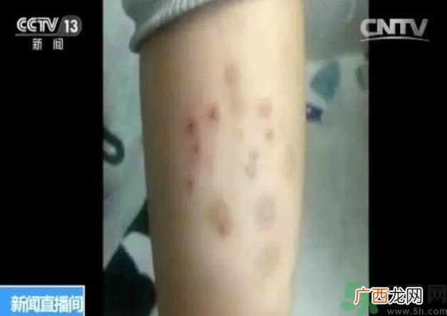 被污染学校是哪个？500师生患病的原因？