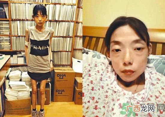 富二代离婚娶二线女星前妻瘦成骷髅怎么选择有责任的男人？