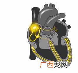窦性心律不齐是什么意思(窦性心律对人有什么