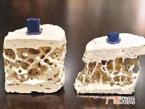 最省钱最实际的食疗补钙技巧 吃什么补钙