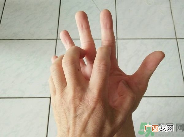手上起水泡是什么原因？怎样预防手上起水泡？