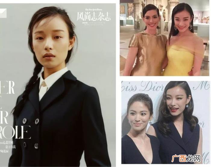 倪妮瘦脸针，圆脸IU、大头倪妮的瘦脸小心机get了