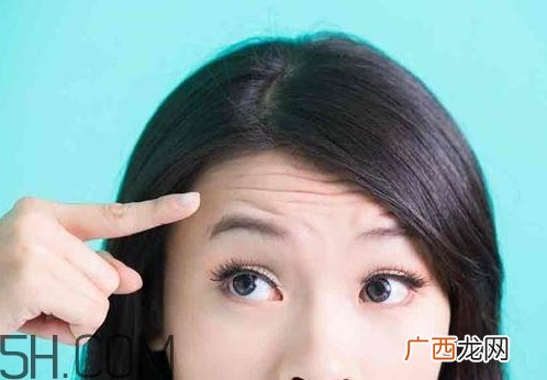抬头纹可以用针灸治疗吗_怎么预防抬头纹
