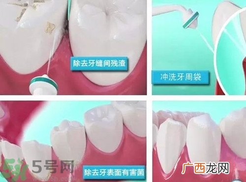 水牙线是什么?水牙线有什么作用
