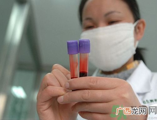 亲子鉴定结果多长时间能出来?亲子鉴定结果怎么看