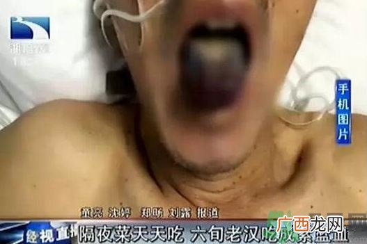 血液变成蓝紫色是为什么?隔夜菜到底能不能吃?
