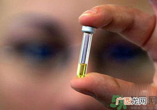 兴奋剂怎么检测?兴奋剂尿检和血检是怎么回事?