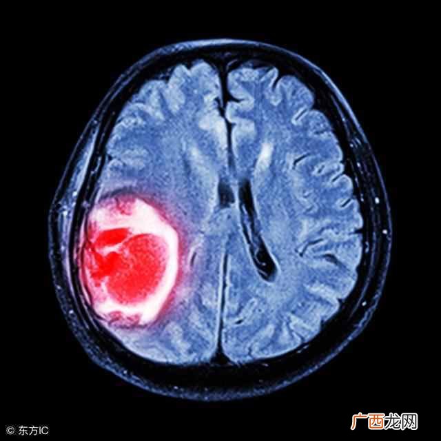 磁共振和CT有什么不一样 磁共振检查什么