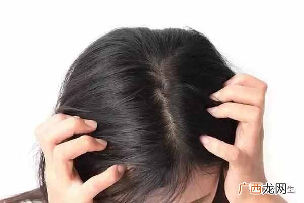 快速有效的治疗方案 头上长痘痘是什么原因