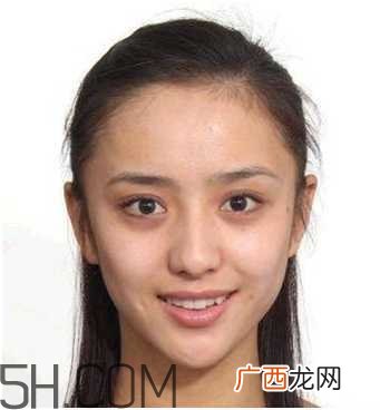 黑眼圈怎么去除既简单有容易 看类型与程度